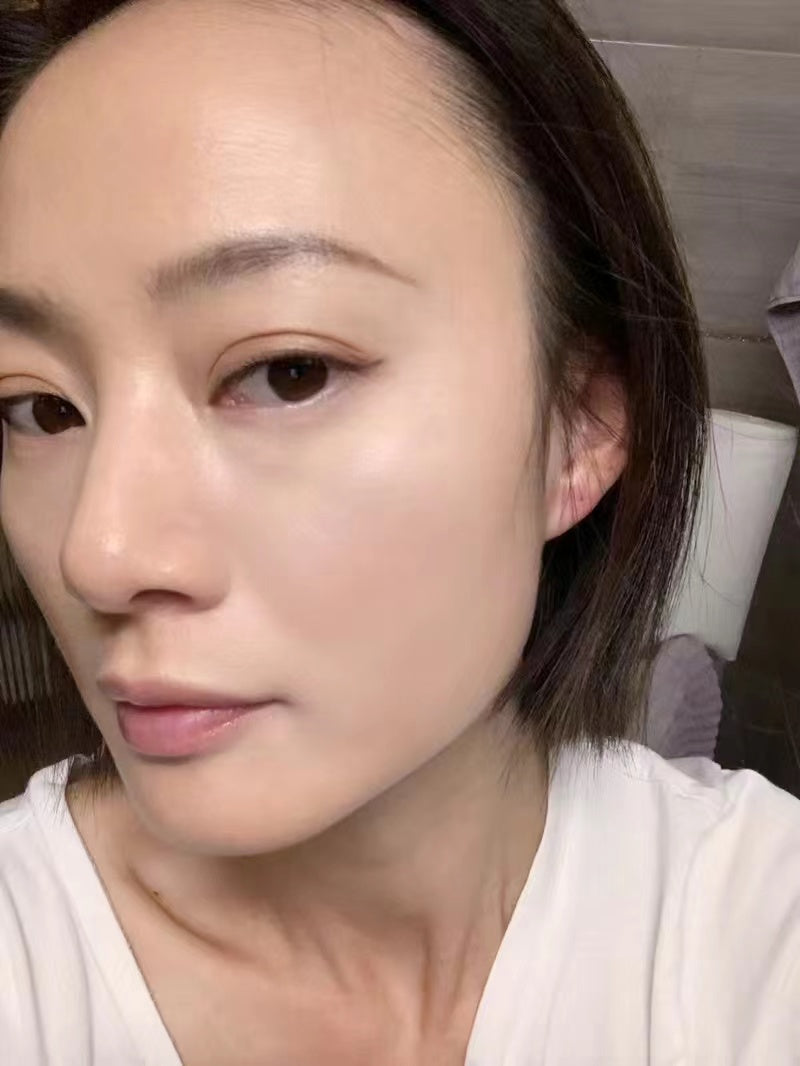 Hana’s skin improvement after 4 weeks of using disposable face towels